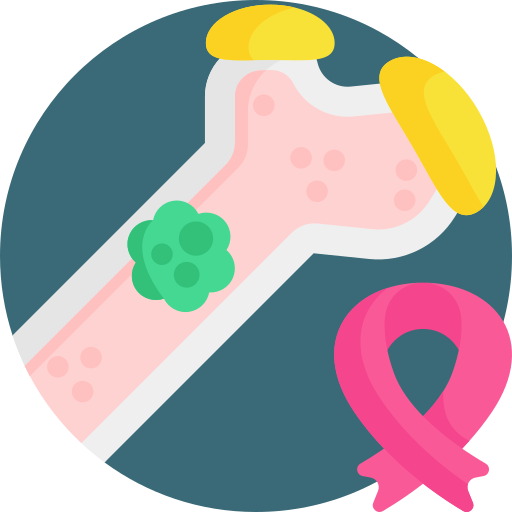 Multiple Myeloma