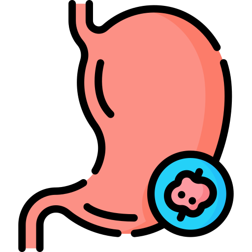 Stomach Cancer