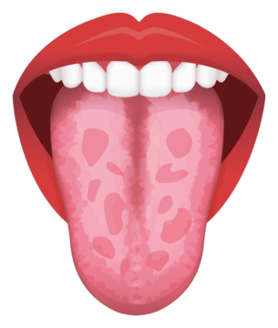 Mouth Cancer