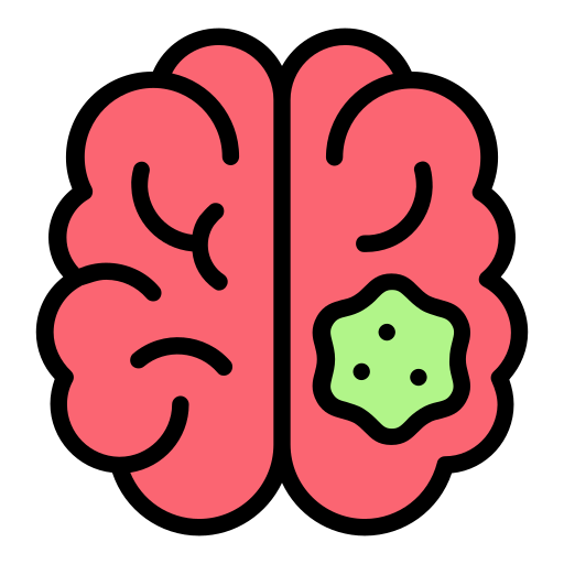 Brain Cysts