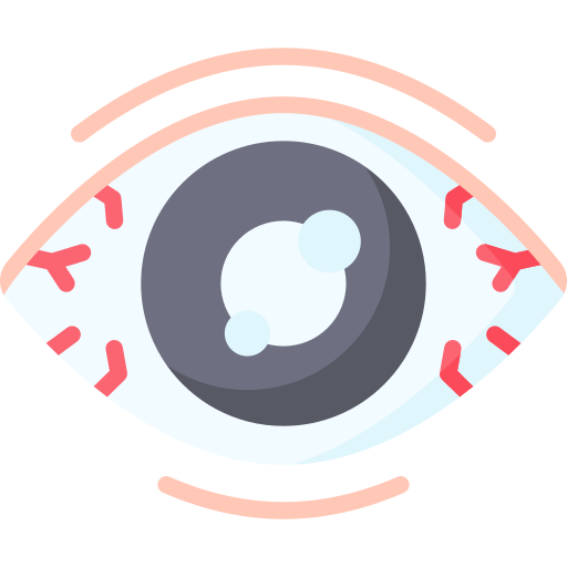 Glaucoma Eye $1200-$2000